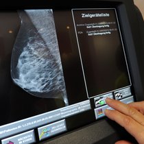 FeminaVita prend en charge les examens gynécologiques préventifs et les dépistages du cancer du sein sans franchise.